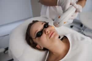 skin laser