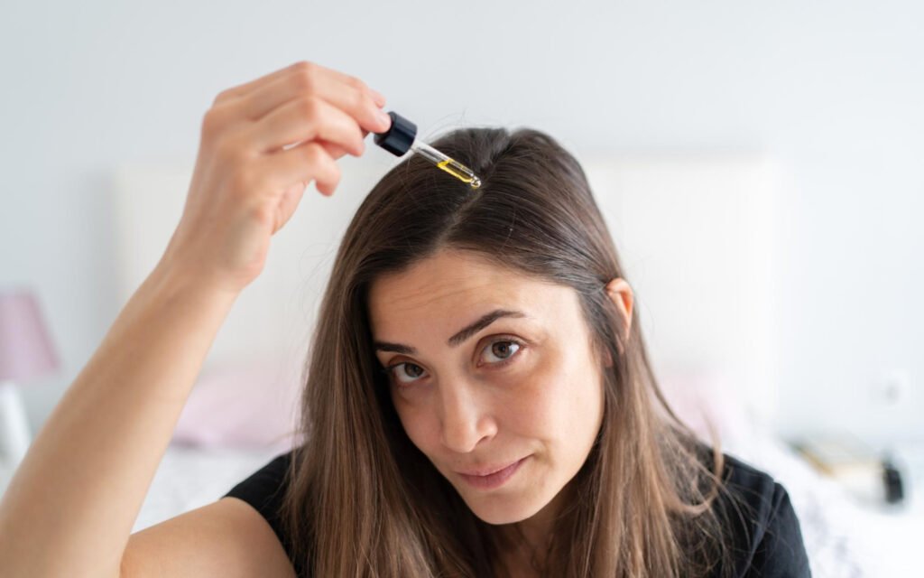 minoxidil mulher