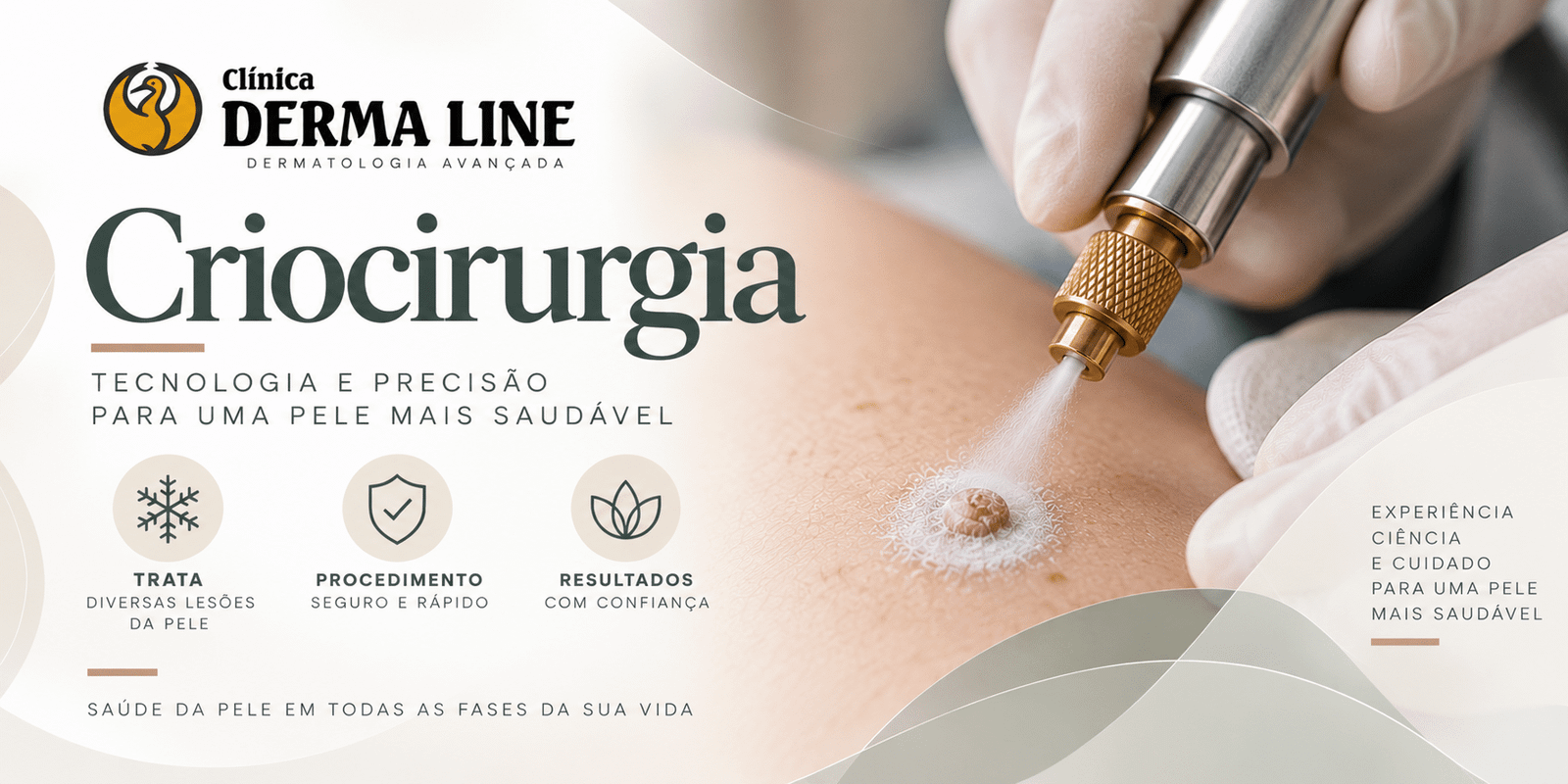 criocirurgia derma line