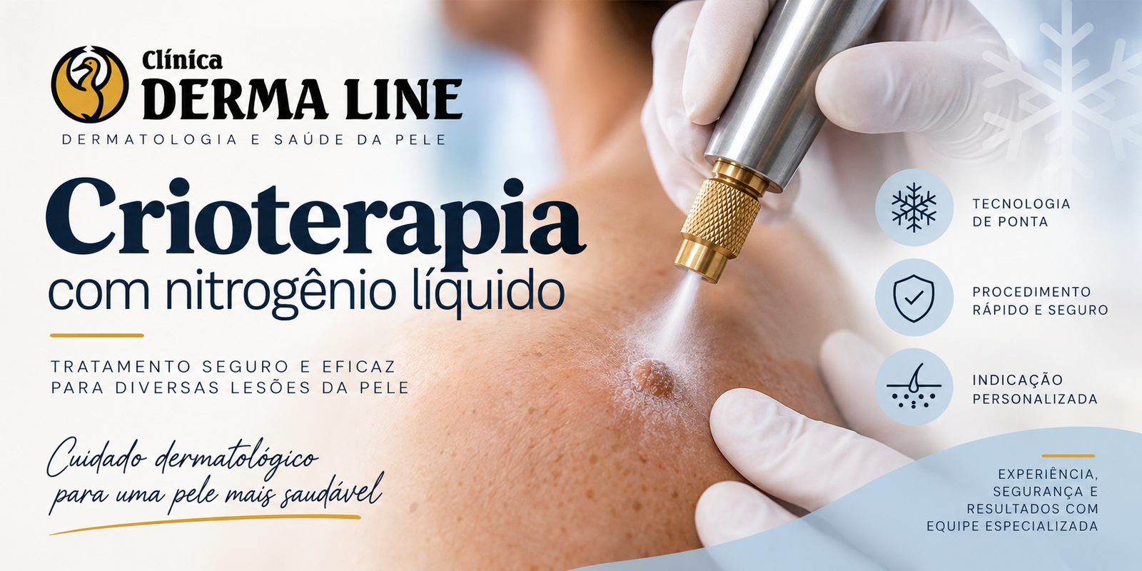 crioterapia com nitrogenio liquido clinica derma line