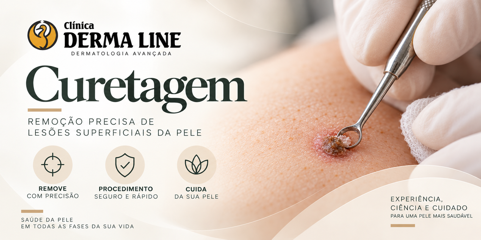curetagem clinica derma line
