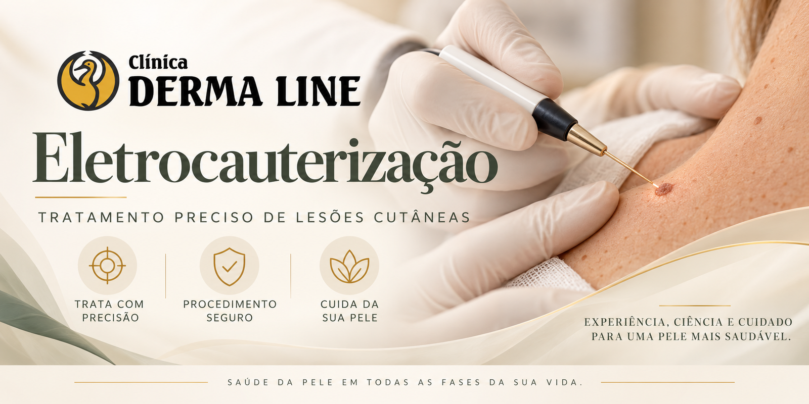 eletrocauterização clinica derma line