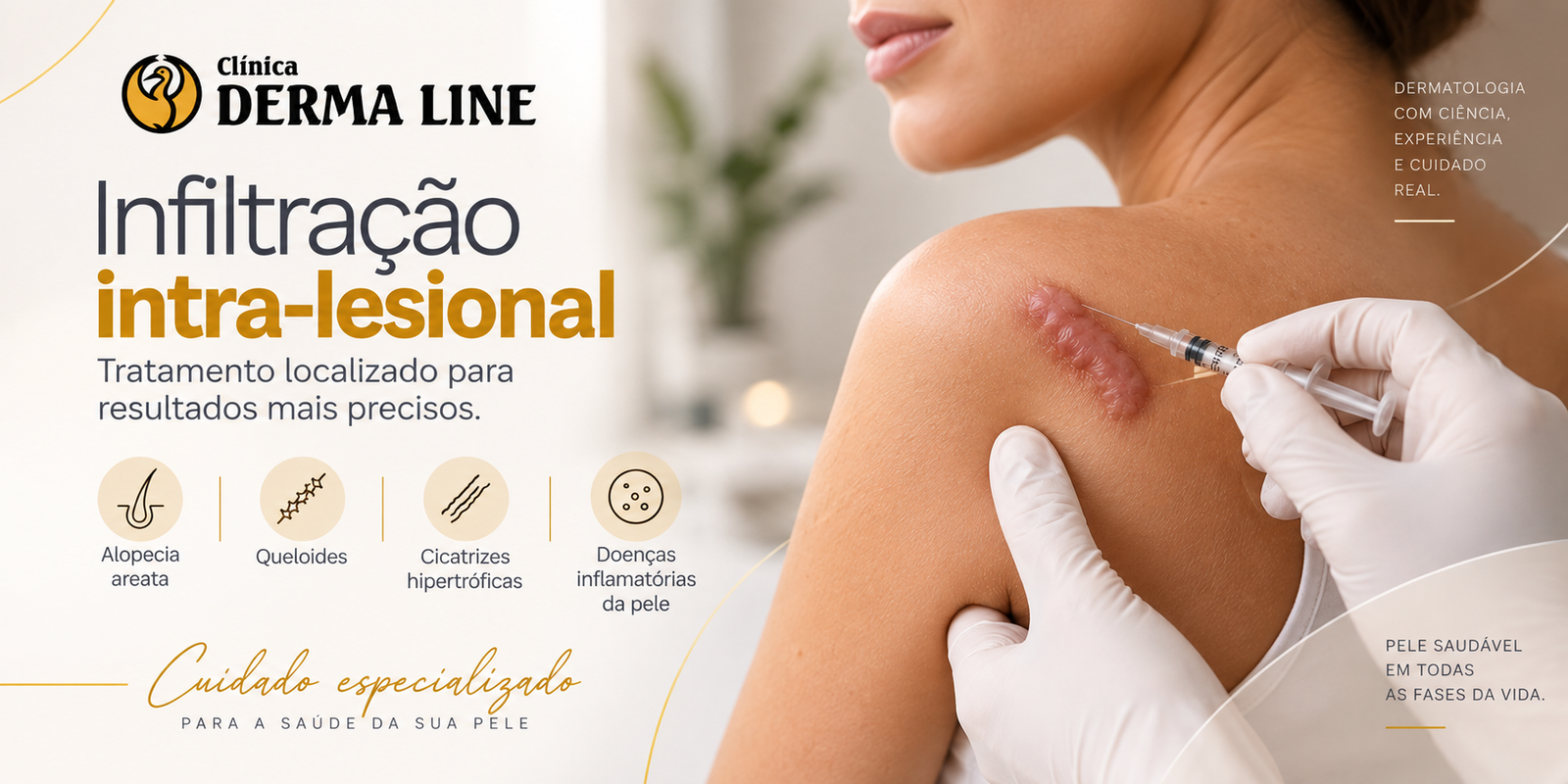 infiltração intra-lesional clinica derma line