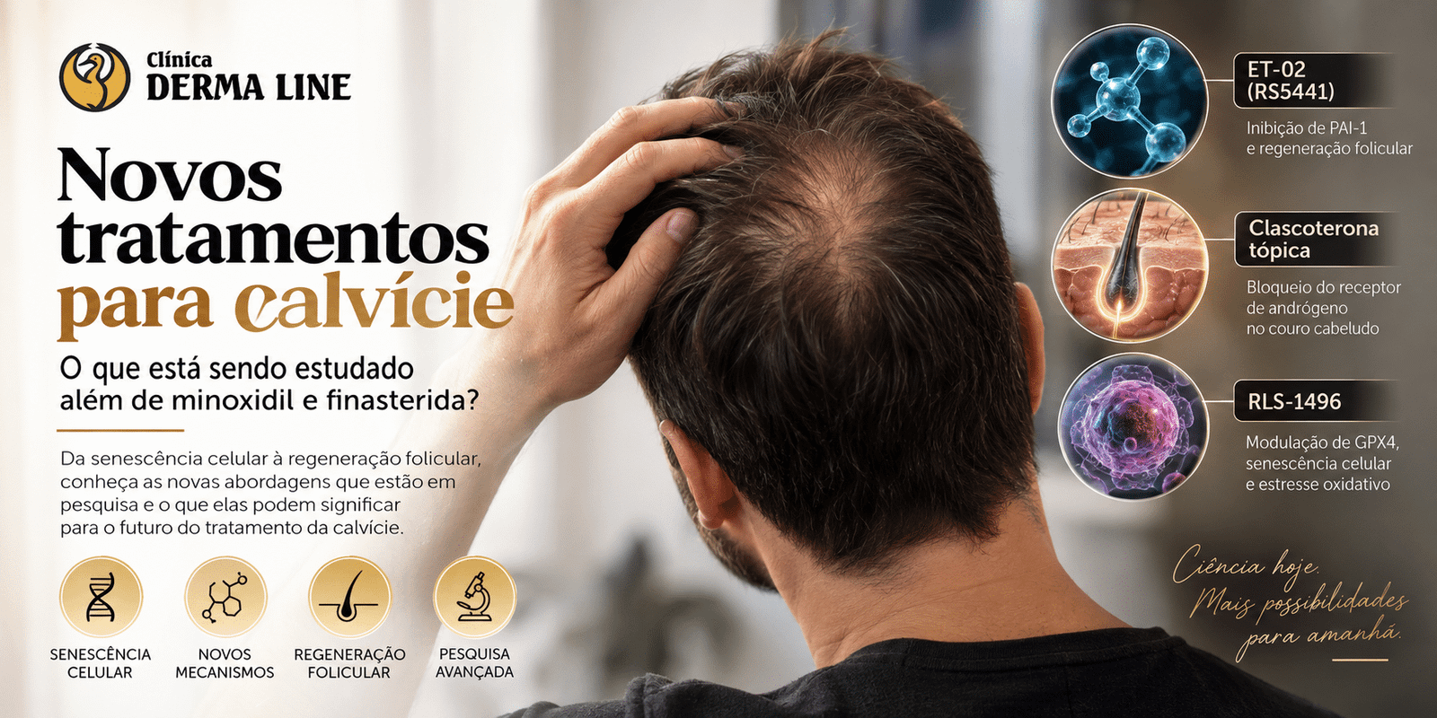 novos tratamentos para calvicie derma line