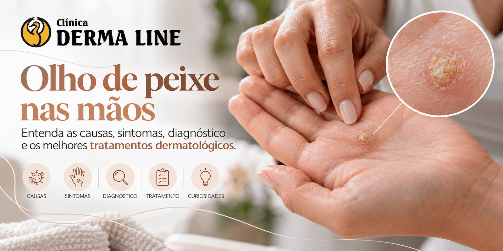 Olho de peixe nas mãos: diagnóstico e tratamento dermatológico
