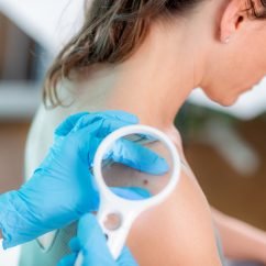 Dermatologista analisando pintas